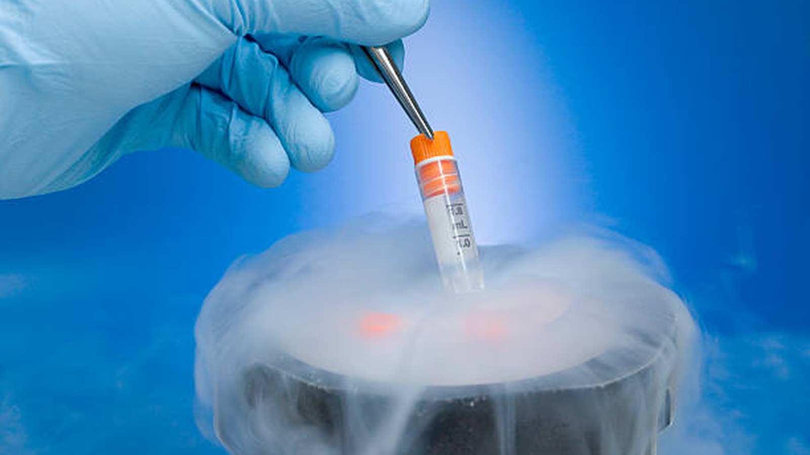 Cryopreservation image