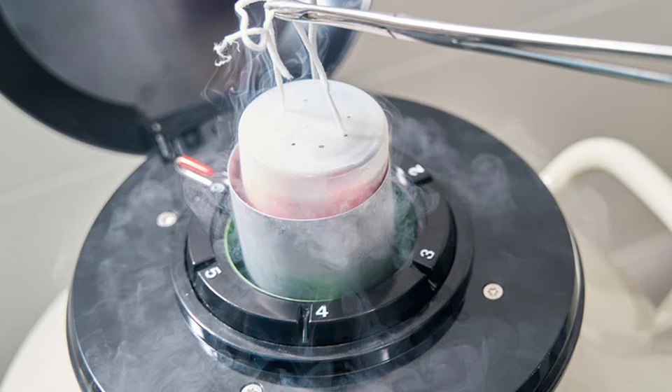 Egg Freezing at MOMZY Women and Fertility Centre