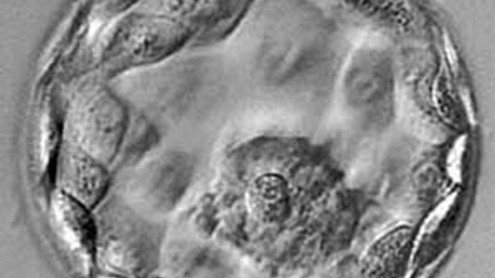 Frozen Embryo Transfer image