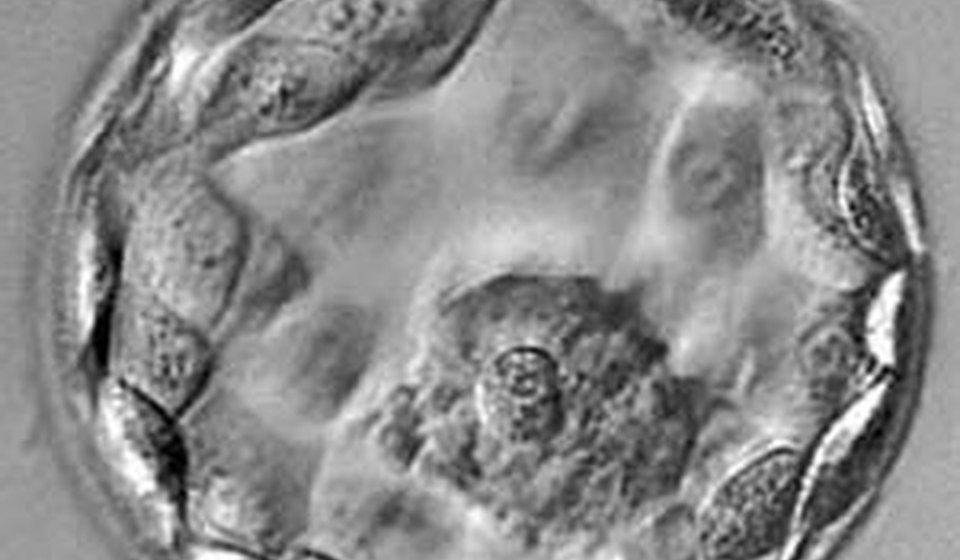 Frozen Embryo Transfer at MOMZY Women and Fertility Centre
