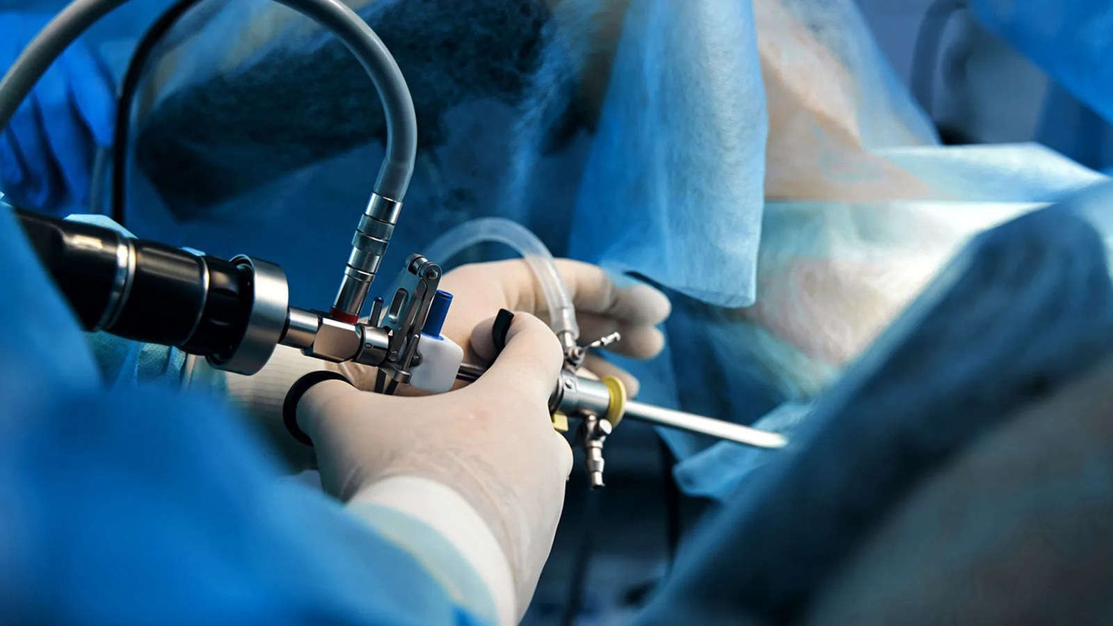 Hysteroscopy image