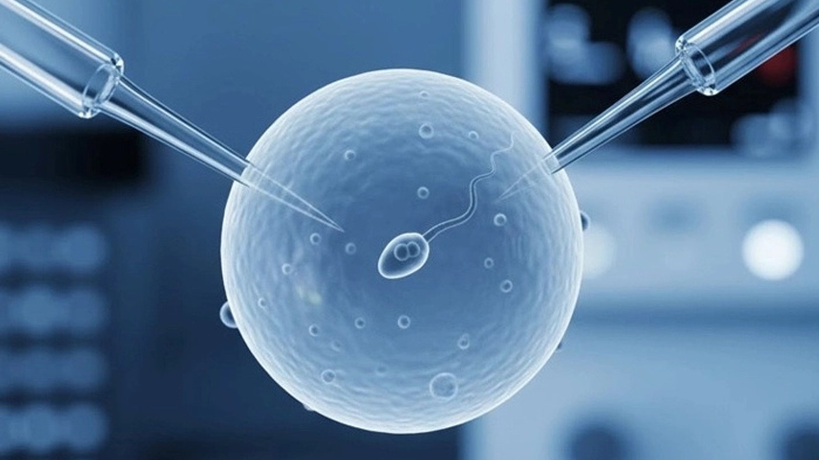 ICSI Treatment image
