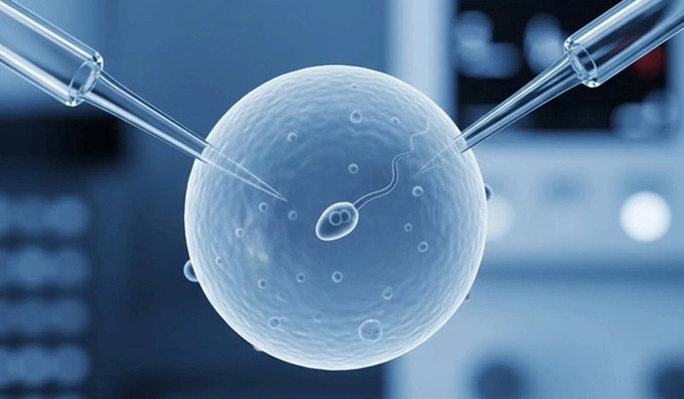 ICSI Treatment at MOMZY Women and Fertility Centre
