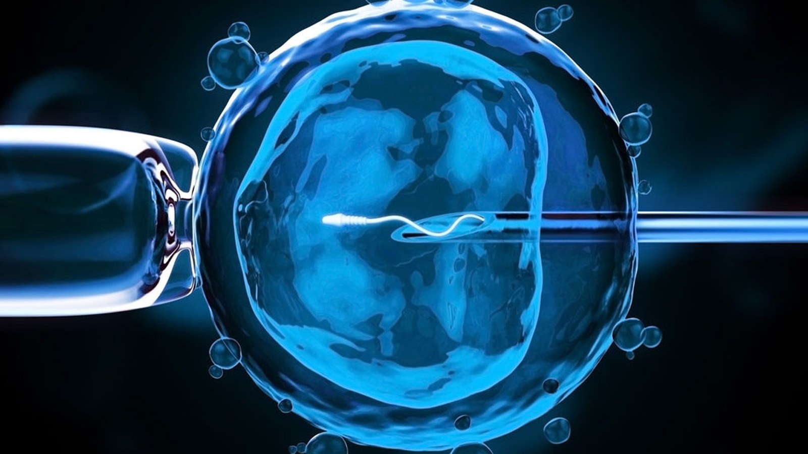 IVF Treatment image