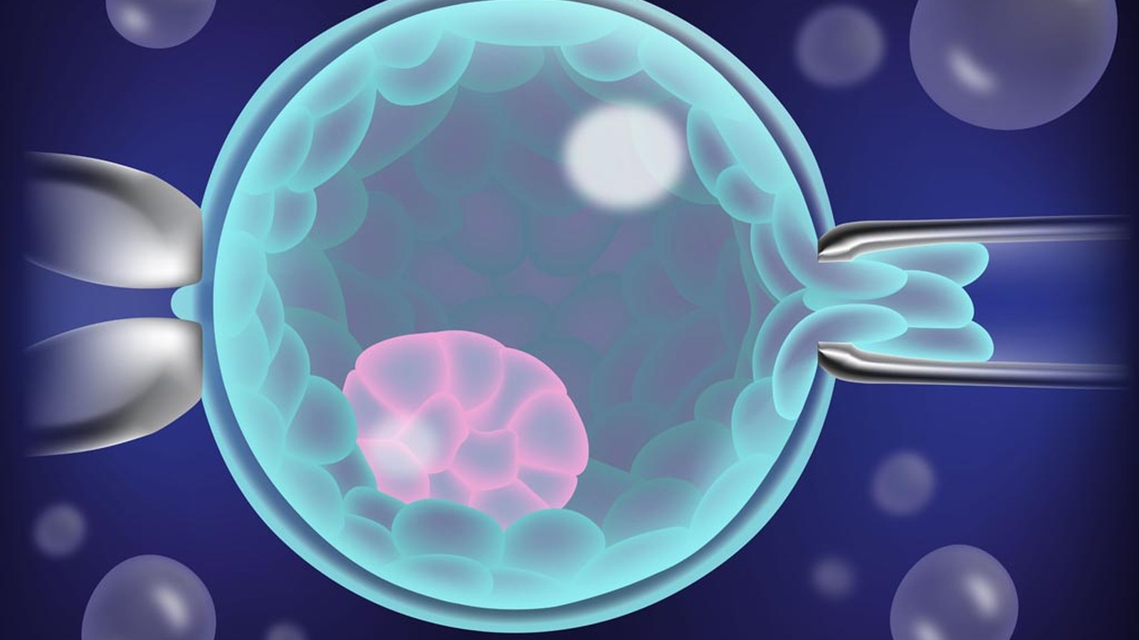 Preimplantation Genetic Testing image