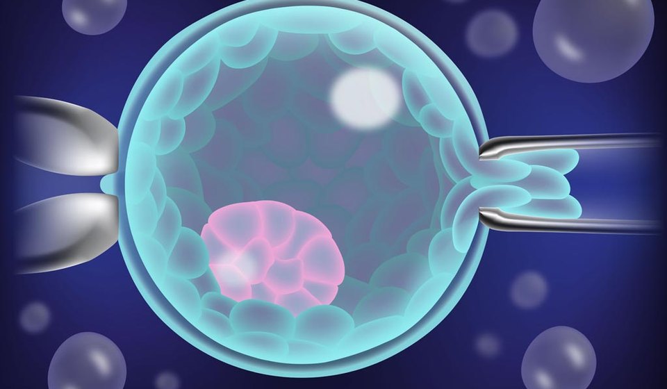 Preimplantation Genetic Testing at MOMZY Women and Fertility Centre