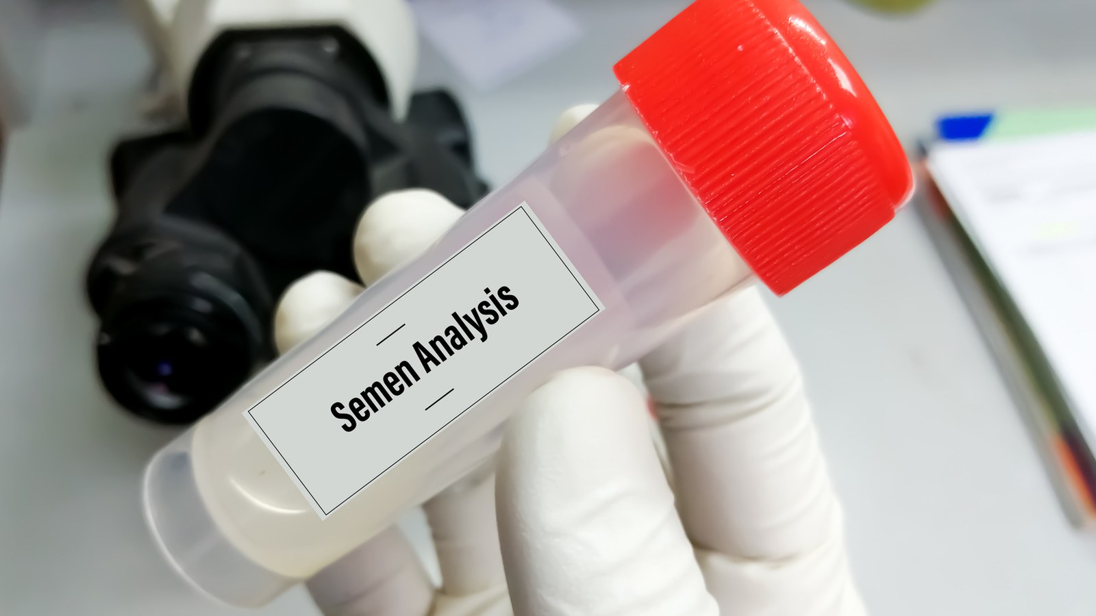 Semen Analysis image