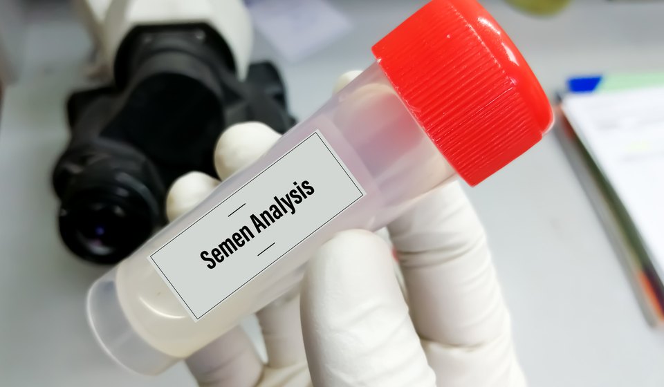 Semen Analysis at MOMZY Women and Fertility Centre