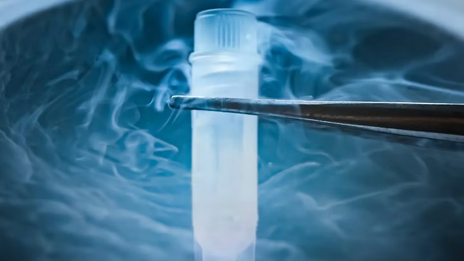 Sperm Freezing image