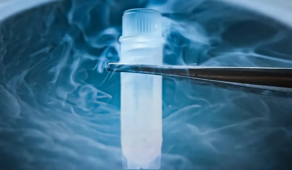 Sperm Freezing at MOMZY Women and Fertility Centre